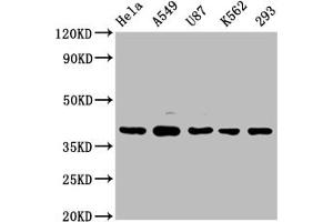 Western Blot Positive WB detected in: Hela whole cell lysate, A549 whole cell lysate, U87 whole cell lysate, K562 whole cell lysate, 293 whole cell lysate All lanes: PIH1D1 antibody at 1:2000 Secondary Goat polyclonal to rabbit IgG at 1/50000 dilution Predicted band size: 33, 20, 22 kDa Observed band size: 39 kDa (PIH1D1 anticorps  (AA 1-290))