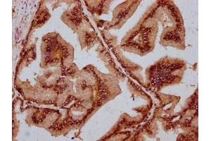 IHC image of ABIN7159037 diluted at 1:800 and staining in paraffin-embedded human prostate tissue performed on a Leica BondTM system.