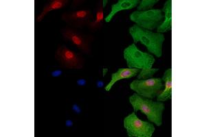 ABIN6258901 and ABIN6273724 staining  cells by IF/ICC.