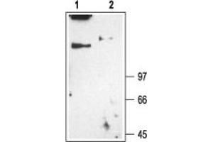 Western blot analysis of rat skeletal muscle membranes: - 1.