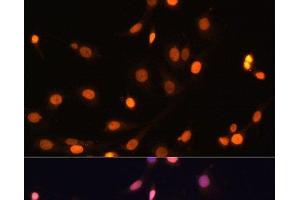 Immunofluorescence analysis of C6 cells using WT1 Polyclonal Antibody at dilution of 1:100. (WT1 anticorps)