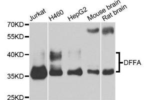 Western blot analysis of extracts of various cell lines, using DFFA antibody.