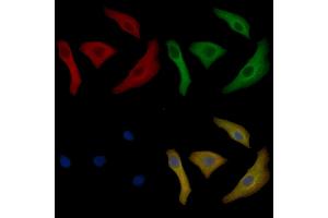 Cytokeratin 17 Mouse Monoclonal Antibody staining Hela cells by IF/ICC. (KRT17 anticorps  (Internal Region))