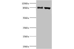 Western blot All lanes: Disintegrin and metalloproteinase domain-containing protein 9 antibody at 2 μg/mL Lane 1: Mouse liver tissue Lane 2: Mouse heart tissue Secondary Goat polyclonal to rabbit IgG at 1/10000 dilution Predicted band size: 91, 73 kDa Observed band size: 91 kDa (ADAM9 anticorps  (AA 475-685))