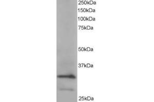 Western Blotting (WB) image for anti-Actin Related Protein 2/3 Complex, Subunit 2, 34kDa (ARPC2) (C-Term) antibody (ABIN2465173) (ARPC2 anticorps  (C-Term))