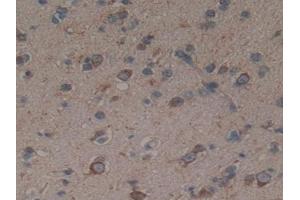 Detection of SHH in Human Brain Tissue using Polyclonal Antibody to Hedgehog Homolog, Sonic (SHH)