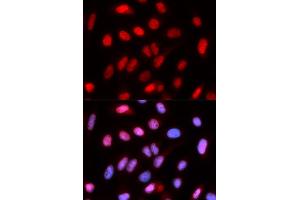 Immunofluorescence analysis of U2OS cells using RFC4 antibody (ABIN5973195). (RFC4 anticorps)