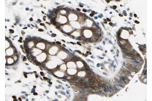 ABIN6267020 at 1/100 staining human Rectum tissue sections by IHC-P. (APC anticorps  (pSer2054))