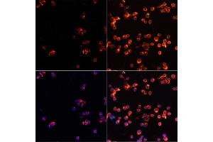 Immunofluorescence analysis of Jurkat cells using CASP3 antibody (ABIN6292881) at dilution of 1:100. (Caspase 3 anticorps)