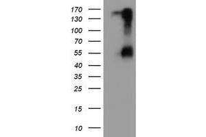 Image no. 3 for anti-serine Peptidase Inhibitor, Kunitz Type 1 (SPINT1) antibody (ABIN1501109)