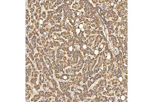 IHC analysis of Citrin/SLC25A13 using anti-Citrin/SLC25A13 antibody (ABIN7599512). (slc25a13 anticorps  (AA 1-643))