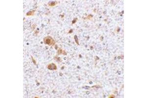 Immunohistochemistry of TSLP in Mouse brain tissue with AP30965PU-N TSLP antibody at 2. (Thymic Stromal Lymphopoietin anticorps  (Center))
