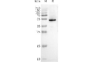 WB analysis of Human C-Nanodisc with anti-Flag monoclonal antibody at 1/5000 dilution, followed by Goat Anti-Rabbit IgG HRP at 1/5000 dilution