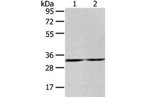 Gel: 8 % SDS-PAGE, Lysate: 40 μg, Lane 1-2: 231 and K562 cell, Primary antibody: ABIN7193107(ZNF146 Antibody) at dilution 1/200 dilution, Secondary antibody: Goat anti rabbit IgG at 1/8000 dilution, Exposure time: 20 seconds (ZNF146 anticorps)