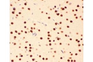 IHC testing of FFPE rat brain tissue with ATF2 antibody at 1ug/ml. (ATF2 anticorps  (AA 93-450))