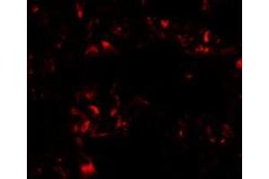 Immunofluorescence analysis of FOXRED2 in human lung with FOXRED2 polyclonal antibody  at 20 ug/mL.