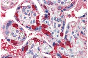 Placenta, Human: Formalin-Fixed, Paraffin-Embedded (FFPE)