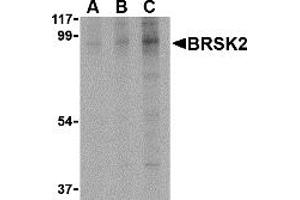 Western Blotting (WB) image for anti-BR serine/threonine Kinase 2 (BRSK2) (C-Term) antibody (ABIN1030303) (BRSK2 anticorps  (C-Term))