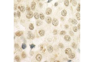 Immunohistochemistry (IHC) image for anti-Papillary Renal Cell Carcinoma (Translocation-Associated) (PRCC) (AA 125-175) antibody (ABIN7454446)