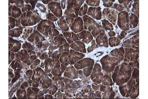 Image no. 5 for anti-DEAD (Asp-Glu-Ala-Asp) Box Polypeptide 58 (DDX58) antibody (ABIN1500708) (DDX58 anticorps)