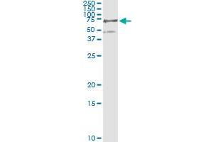 Western Blotting (WB) image for anti-Phosphoglucomutase 3 (PGM3) (AA 1-543) antibody (ABIN598868) (Phosphoglucomutase 3 anticorps  (AA 1-543))