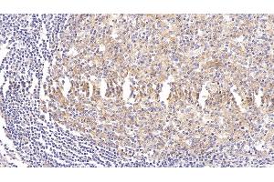 Detection of ICAM1 in Human Tonsil Tissue using Monoclonal Antibody to Intercellular Adhesion Molecule 1 (ICAM1)
