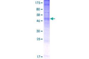 Image no. 1 for Post-GPI Attachment To Proteins 3 (PGAP3) (AA 1-320) protein (GST tag) (ABIN1314665)