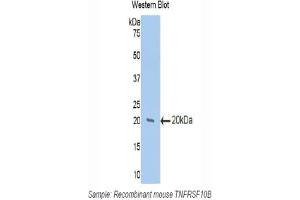 Western blot analysis of the recombinant protein. (TNFRSF10B anticorps  (AA 233-367))