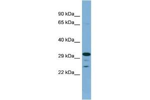 WB Suggested Anti-DHRS9 Antibody Titration: 0. (DHRS9 anticorps  (Middle Region))