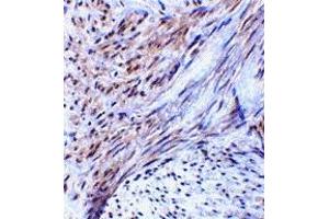 Immunohistochemistry (IHC) image for anti-Tripartite Motif Containing 5 (TRIM5) (Middle Region 2) antibody (ABIN1031206) (TRIM5 anticorps  (Middle Region 2))