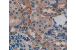 IHC-P analysis of Rat Tissue, with DAB staining. (LRP5 anticorps  (AA 102-336))