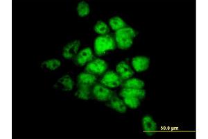 Immunofluorescence of monoclonal antibody to STK33 on A-431 cell.