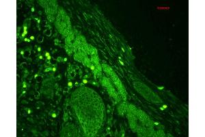 Immunohistochemistry analysis using Rabbit Anti-Rab4 Polyclonal Antibody . (Rab4 anticorps  (C-Term) (PE))