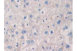 anti-Microtubule-Associated Protein, RP/EB Family, Member 1 (MAPRE1) (AA 2-268) antibody