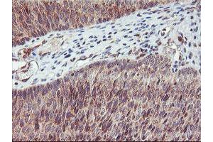 Image no. 4 for anti-1-Acylglycerol-3-Phosphate O-Acyltransferase 5 (Lysophosphatidic Acid Acyltransferase, Epsilon) (AGPAT5) antibody (ABIN1496497)