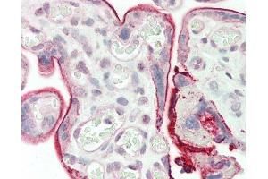 Formalin-fixed and paraffin-embedded H.