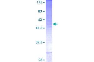 Image no. 1 for Insulin-Like 5 (INSL5) (AA 1-135) protein (GST tag) (ABIN1307977)
