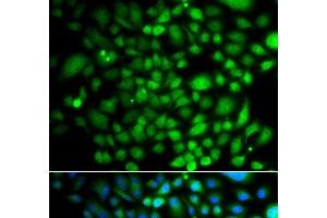 Immunofluorescence analysis of A549 cells using PTK6 Polyclonal Antibody (PTK6 anticorps)