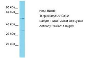 AHCYL2 anticorps  (AA 50-99)