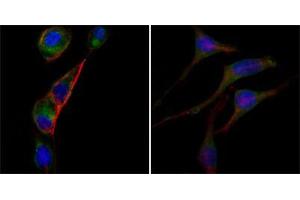 Immunofluorescence analysis of PC-3 (left) and SK-BR-3 (right) cells using anti-GOT2 mAb (green). (GOT2 anticorps)