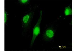 Immunofluorescence of monoclonal antibody to NXF3 on HeLa cell. (NXF3 anticorps  (AA 1-531))