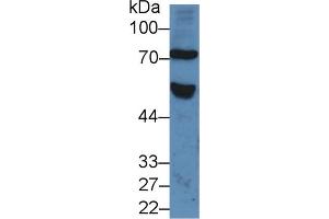 Western Blot; Sample: Human Serum; Primary Ab: 5µg/ml Rabbit Anti-Human FZD1 Antibody Second Ab: 0. (FZD1 anticorps  (AA 117-322))