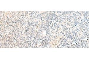 Immunohistochemistry of paraffin-embedded Human tonsil tissue using SNRPD1 Polyclonal Antibody at dilution of 1:70(x200) (SNRPD1 anticorps)