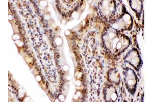 LDHA was detected in paraffin-embedded sections of rat intestine tissues using rabbit anti- LDHA Antigen Affinity purified polyclonal antibody (Catalog # ) at 1 ?