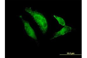 Immunofluorescence of purified MaxPab antibody to TBX20 on HeLa cell. (TBX20 anticorps  (AA 1-297))