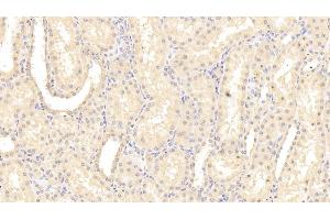 Detection of IL1RL1 in Human Kidney Tissue using Polyclonal Antibody to Interleukin 1 Receptor Like Protein 1 (IL1RL1) (IL1RL1 anticorps  (AA 162-349))