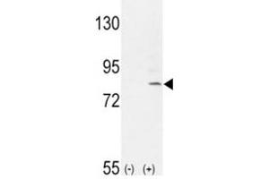 Western blot analysis of FGFR1 antibody and 293 cell lysate (2 ug/lane) either nontransfected (Lane 1) or transiently transfected with the FGFR1 gene (2).