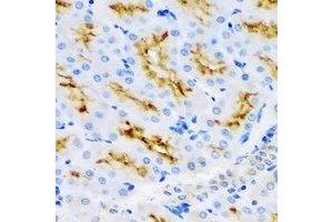 Immunohistochemistry (IHC) image for anti-UDP-Glucose 6-Dehydrogenase (UGDH) antibody (ABIN7308478)
