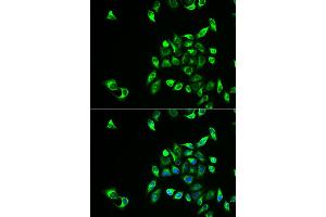 Immunofluorescence analysis of HeLa cell using CSNK1A1L antibody.