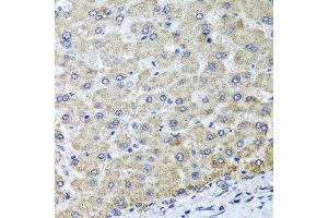 Immunohistochemistry of paraffin-embedded human liver injury using OSGEPL1 antibody at dilution of 1:100 (x40 lens). (OSGEPL1 anticorps)